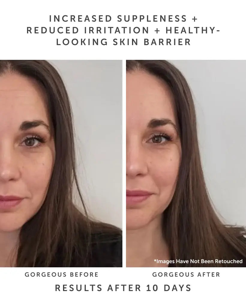 Earth Harbor Naturals | HORIZON Ceramide Repair Serum