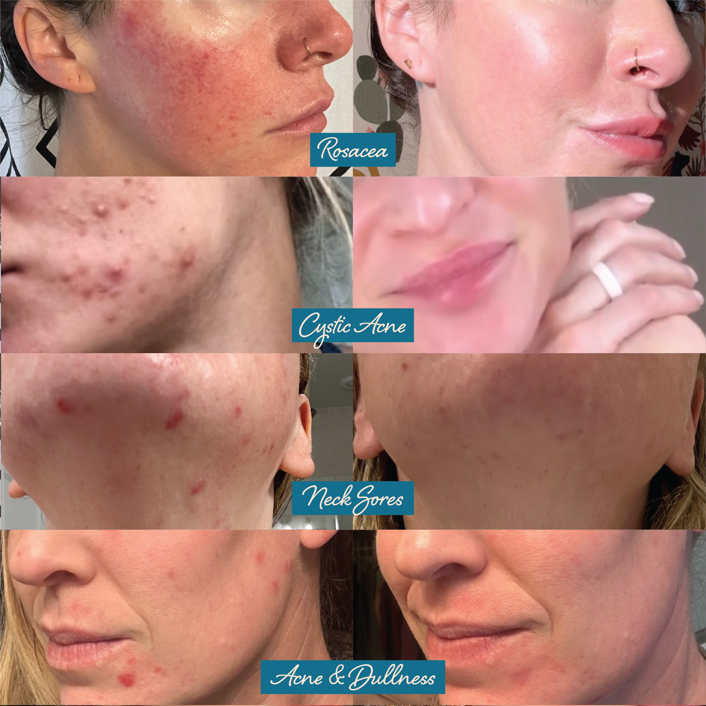 Darlin' | Blue Tansy + Tallow Face Balm